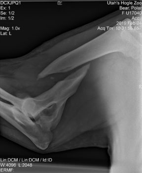 An X-ray image of Nora's injury
