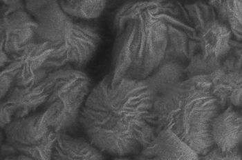 Electron micrograph showing ridges and grooves on MAP hydrogel microbeads caused by developing stem cells.