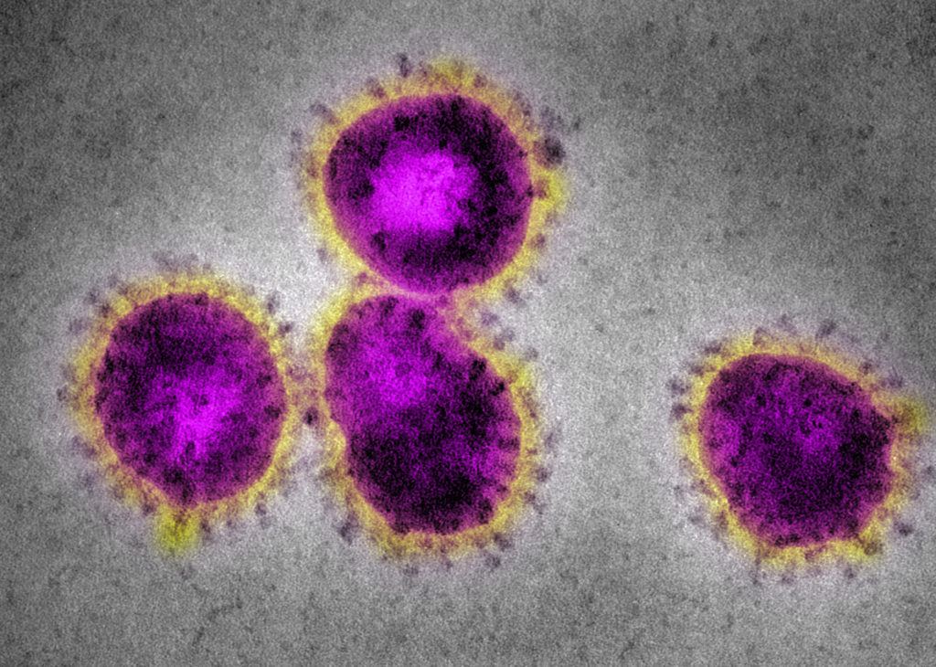 image of the coronavirus