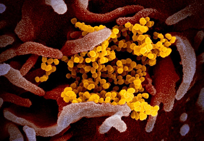 microscope image of SARS-CoV-2