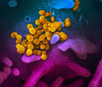 microscope image of SARS-CoV-2