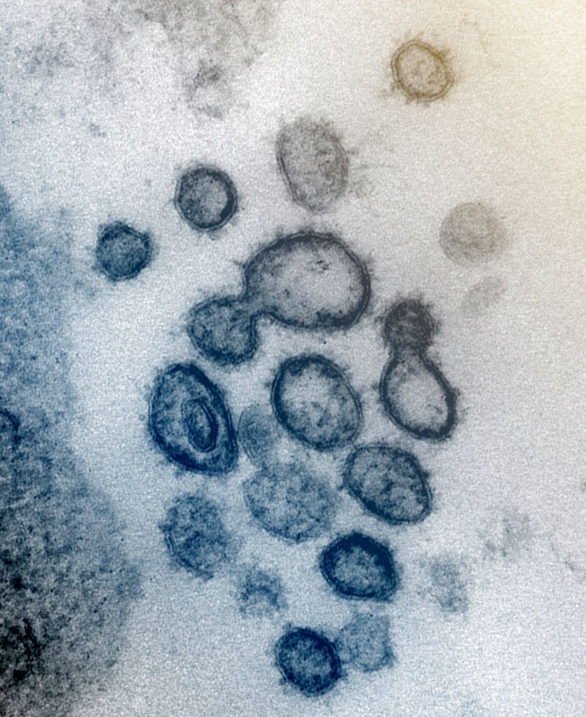 Virus particles are shown emerging from the surface of cells cultured in a lab.