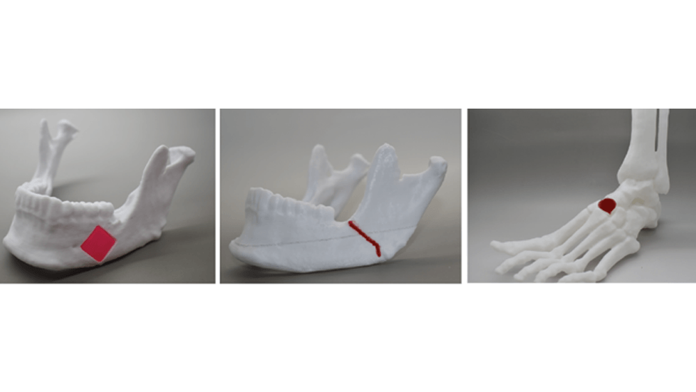 3D printed jaw, foot models