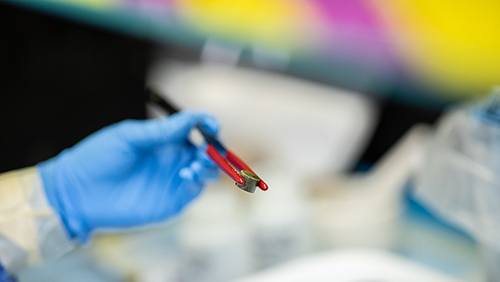 close up of gloved hand holding pellet with forceps