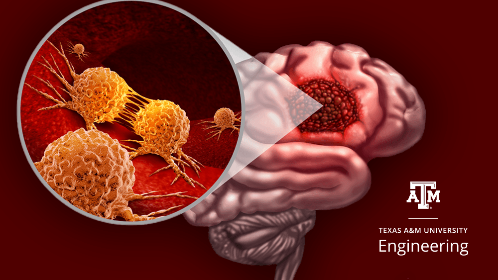 glioblastoma illustration