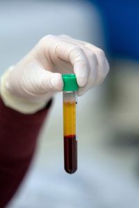 close up of gloved hand holding tube of blood