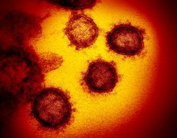 SARS-CoV-2 microscopic image
