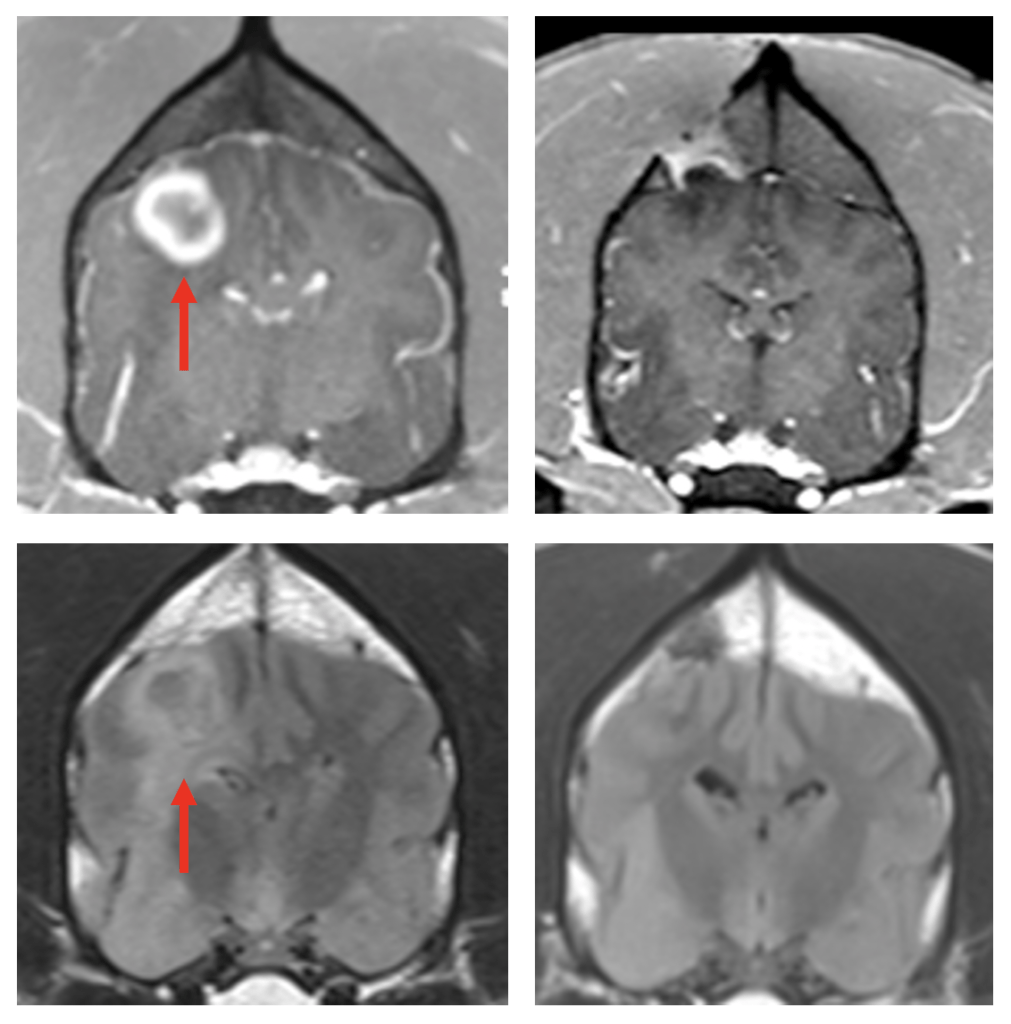 a grid of four black and white brain scans