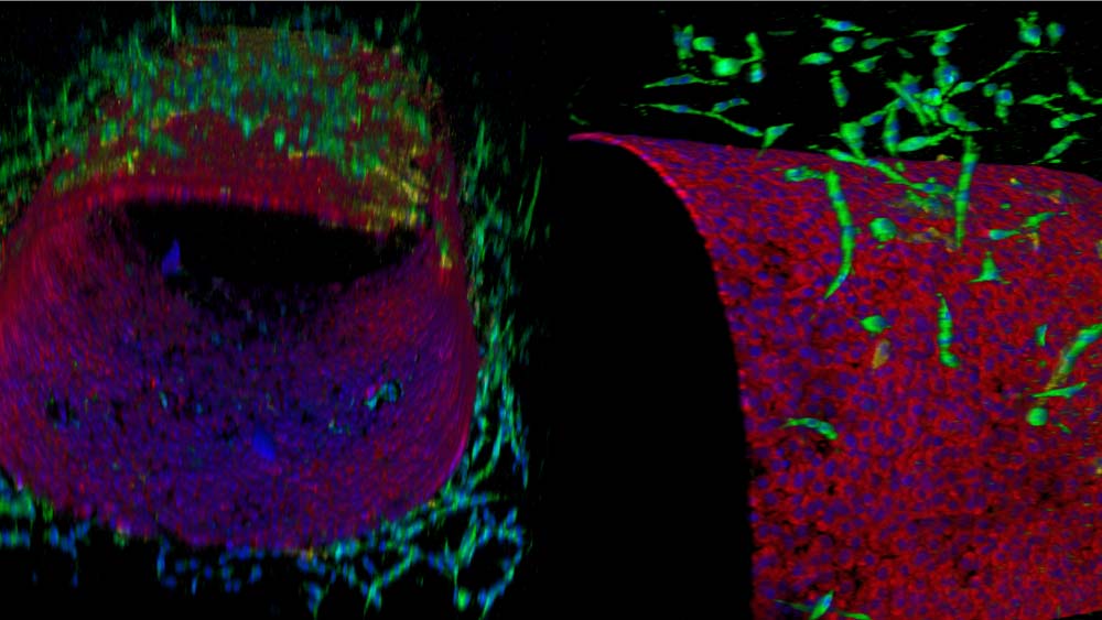 A digital view of a multicellular lymphangion-chip consisting of living co-cultures of lymphatic endothelial and muscle cells in 3D under flow.