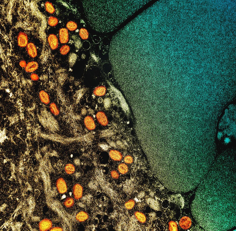 electron micrograph image of monkeypox