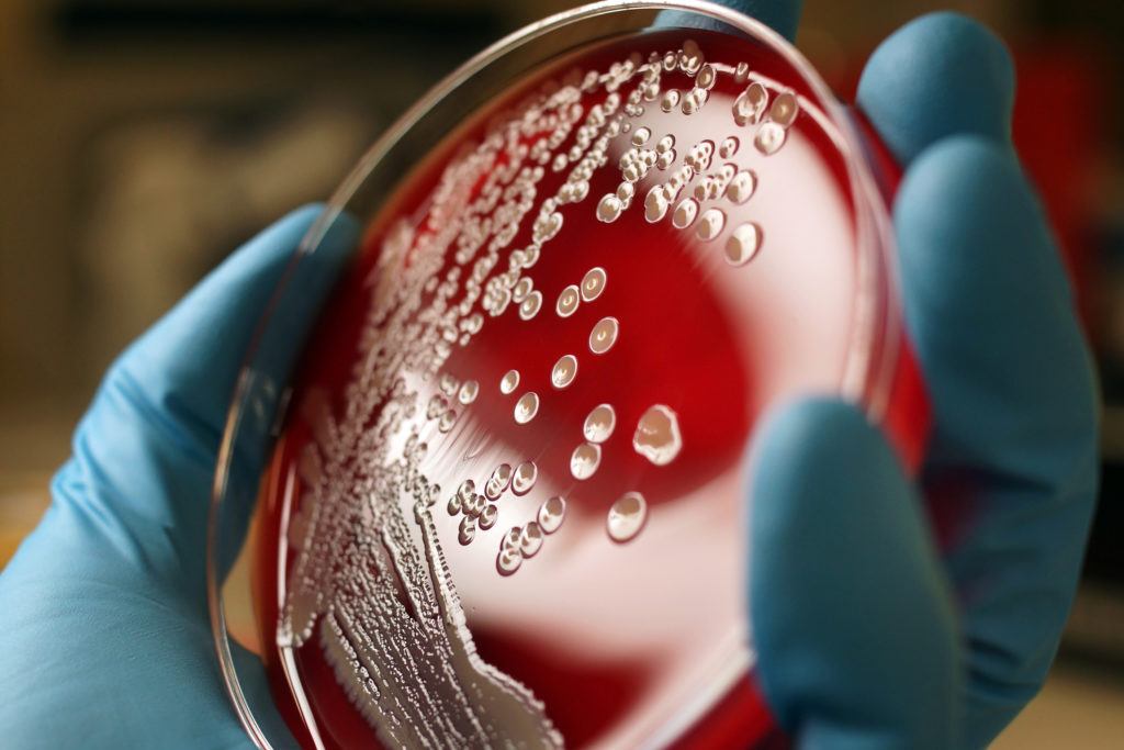 a gloved handle holding a petri dish with bacteria