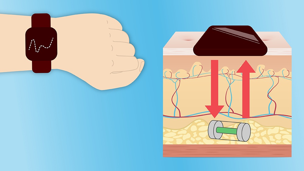 artist's illustration of a person's wrist wearing a watch and a device injected under the skin