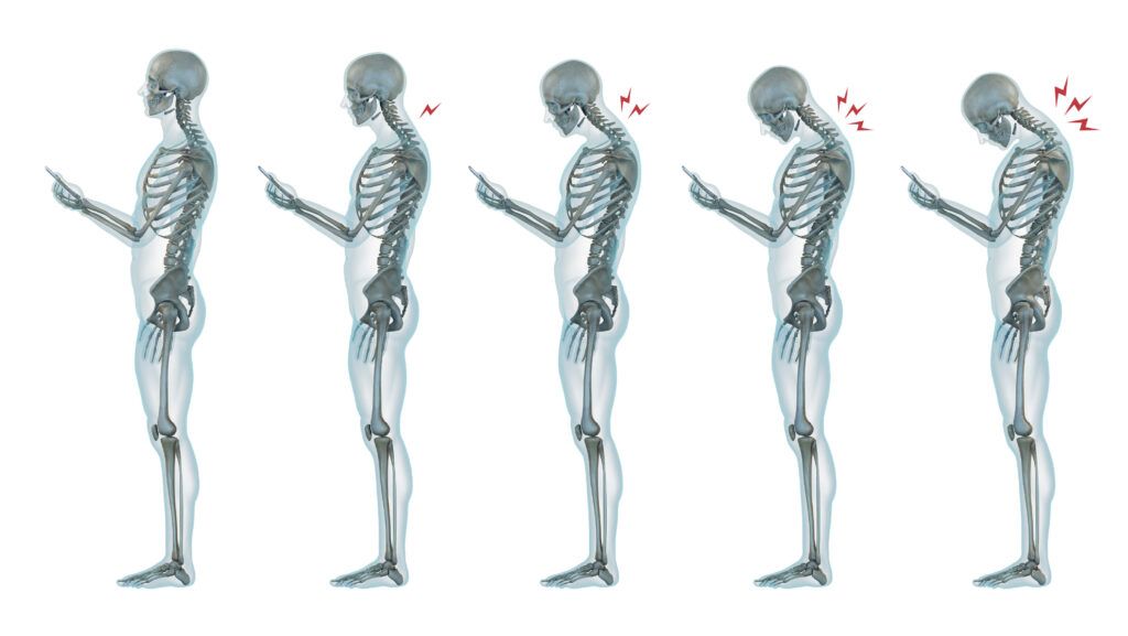 a drawn series of skeletons looking at phones with increasingly poor posture and neck pain indicated by lightning bolts