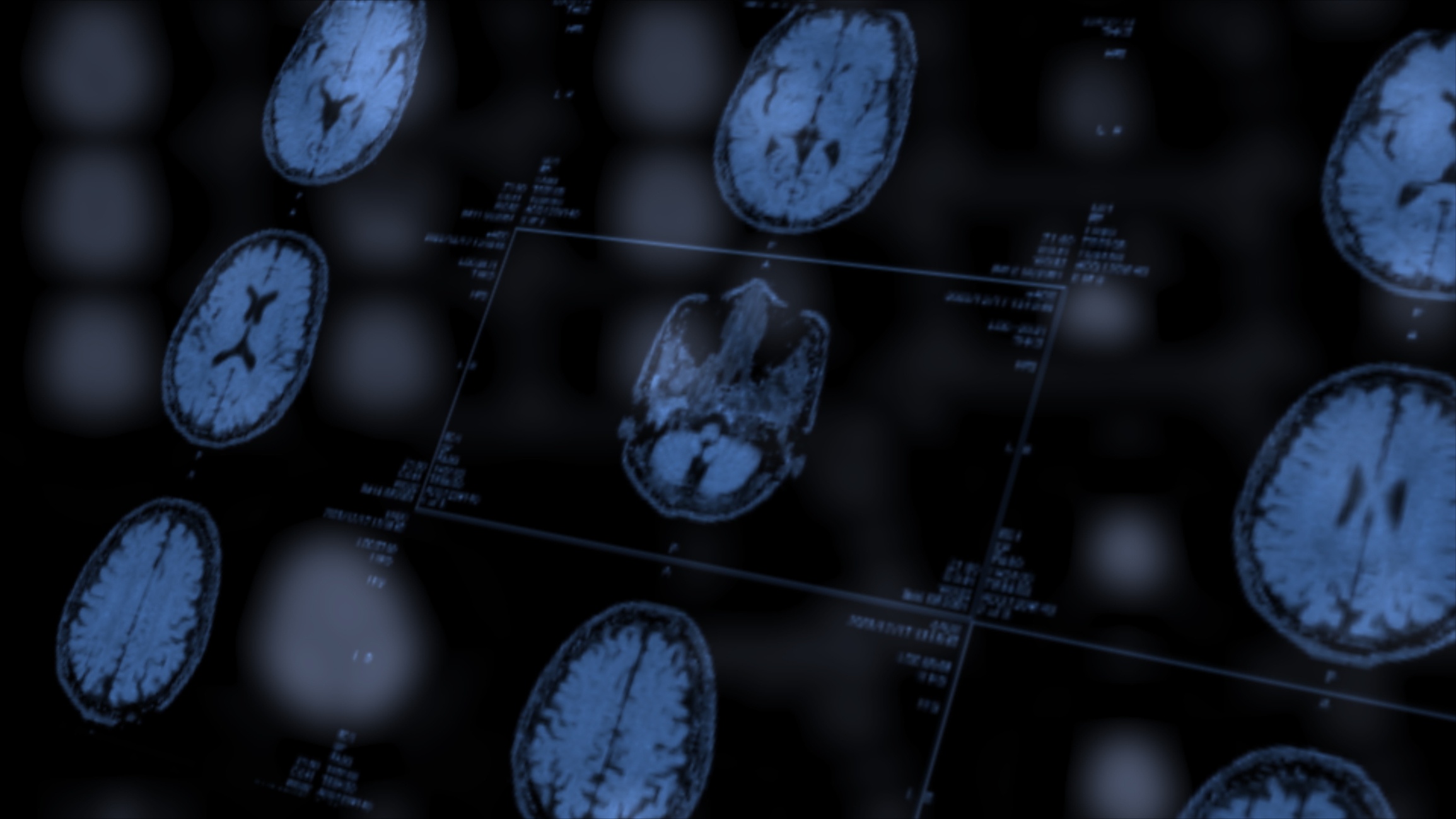 digitally generated scans of a human brain