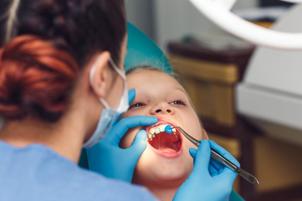 dentist fluoridates a child's teeth. Strengthening of tooth enamel