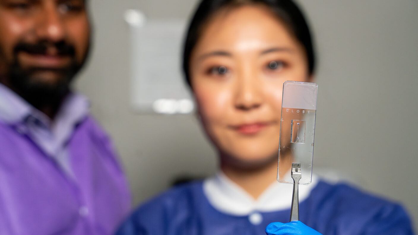 A photo of a researcher holding a vessel-chip related to vascular disease research.
