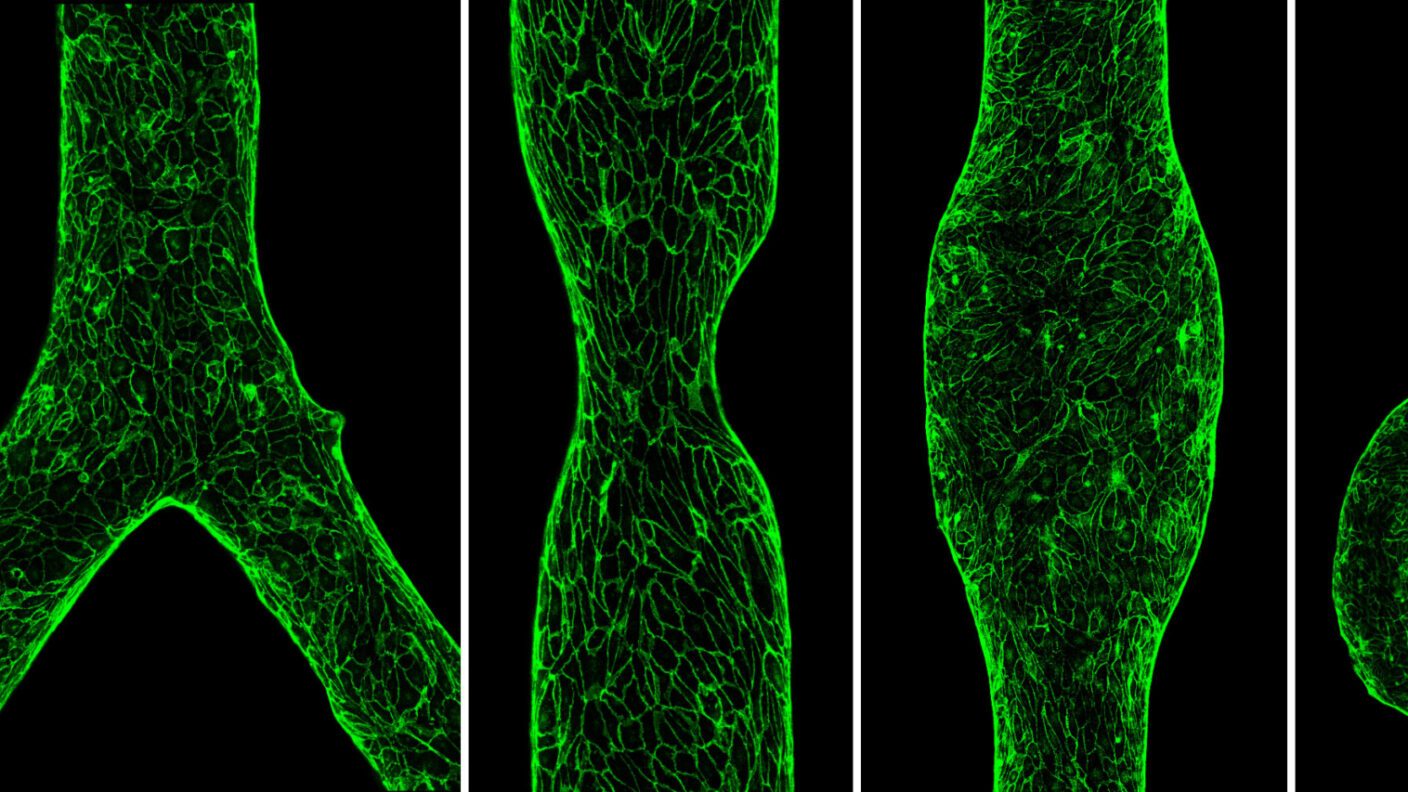 A photo of five different blood vessel shapes that have been replicated in a lab.