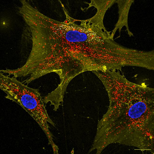 A microscopic image showing how nanoflowers (white) help healthy cells (yellow) deliver energy-producing mitochondria (red) to neighboring cells. Nuclei are stained blue.