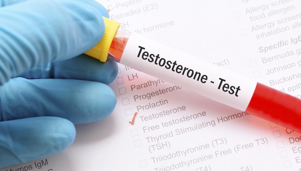 Blood sample for testosterone hormone test